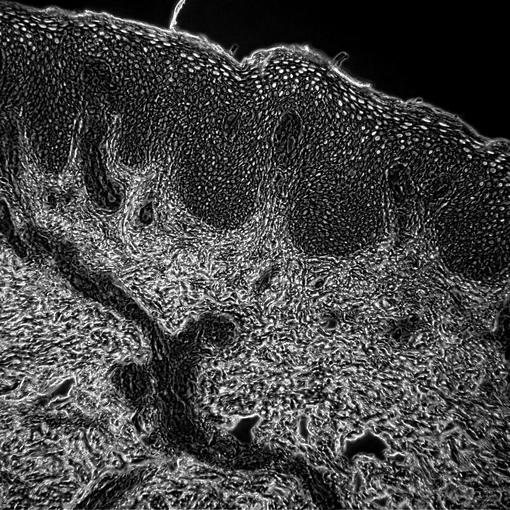 Phase contrast image